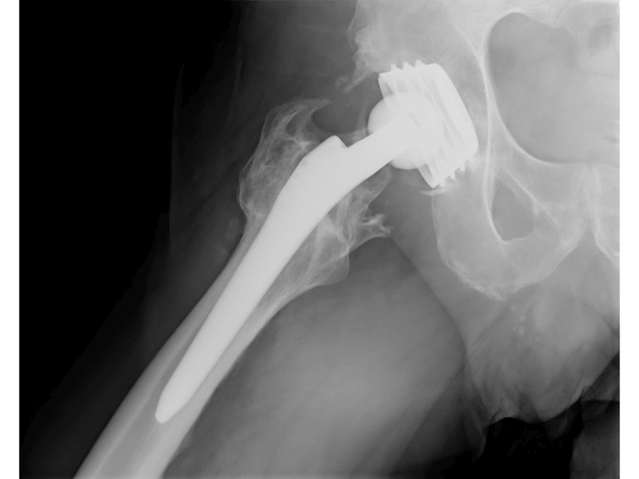 Rehabilitación postquirúrgica