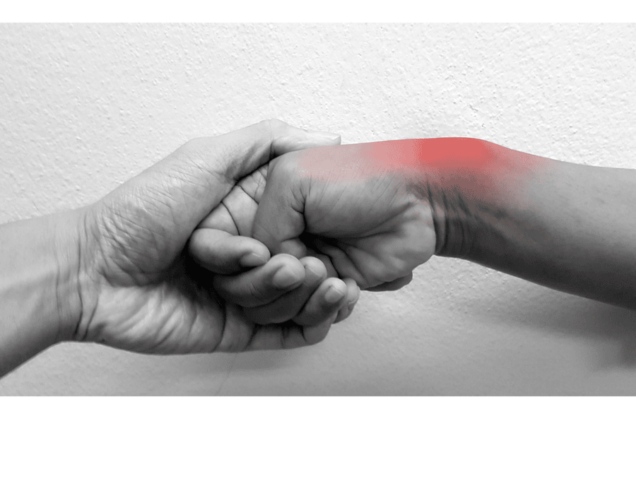 Tenosinovitis de Quervain