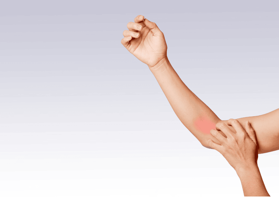 Tenosinovitis de Quervain